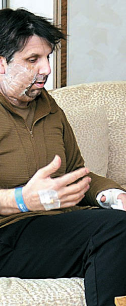 ソウル新村セブランス病院に入院中のリッパート駐韓米国大使は８日、顔の包帯は外し、貫通傷を負った左腕だけ包帯を巻いている。（写真＝セブランス病院）