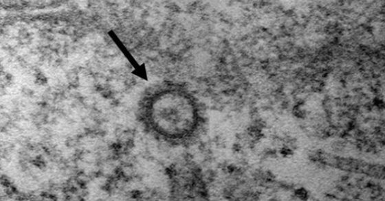疾病管理本部が２７日に公開した新型コロナウイルスの高解像電子顕微鏡写真。［写真　疾病管理本部］