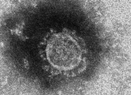 電子顕微鏡で見た新型コロナウイルス。［写真　日本国立感染症研究所］