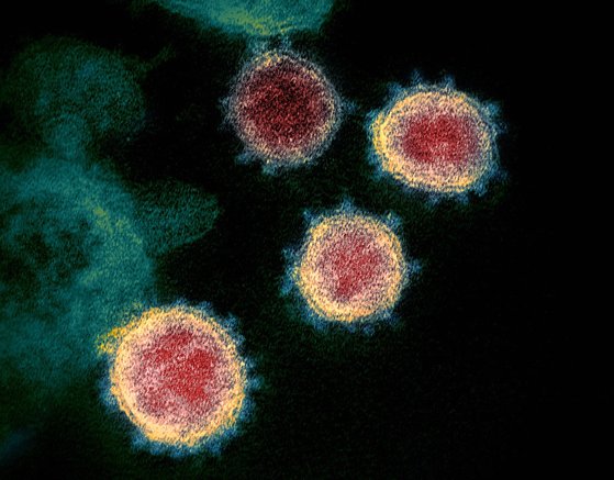 新型コロナウイルス感染症を起こすウイルスの電子顕微鏡写真。　［米国立アレルギー感染病研究所］