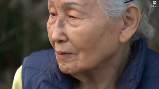 顔を殴られた８０代韓国系女性［米ＡＢＣホームページ　キャプチャー］