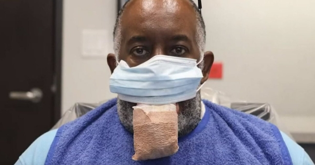 米国ヒューストンに住むアントニー・ジョーンズさんは最近、新型コロナウイルス感染症（新型肺炎）感染後、巨舌症を発病した。［写真　ＹｏｕＴｕｂｅキャプチャー］