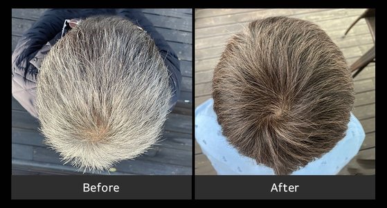 ヘアカラー剤製造・販売会社「モダモダ」のシャンプーを使用した前（左）と８週間後（右）の６０代男性の髪の毛の色の変化。白髪だったが褐変現象のために髪の毛が黒褐色に変わった。［写真　モダモダ］