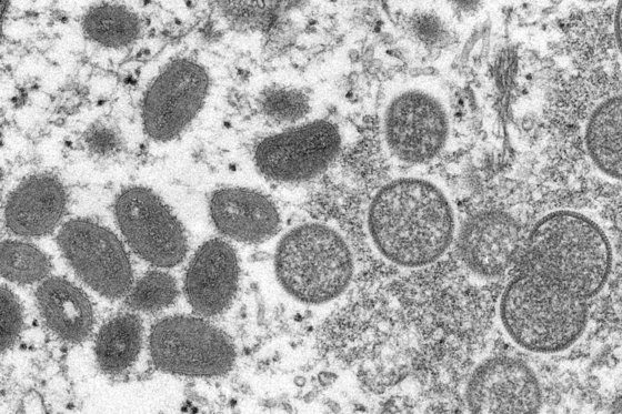 米国疾病予防管理センターが提供したサル痘ウイルスのイメージ［写真　米国疾病予防管理センター］