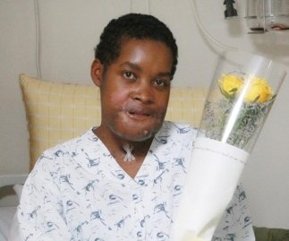 巨大細胞肉芽腫で苦しんでいたプランジさんが韓国で手術した後、治療を受けて回復している様子。［写真　ソウル峨山（アサン）病院］