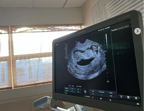 大坂なおみが１１日に公開した妊娠関連の超音波写真。［Ｎａｏｍｉ　Ｏｓａｋａ　インスタグラム］
