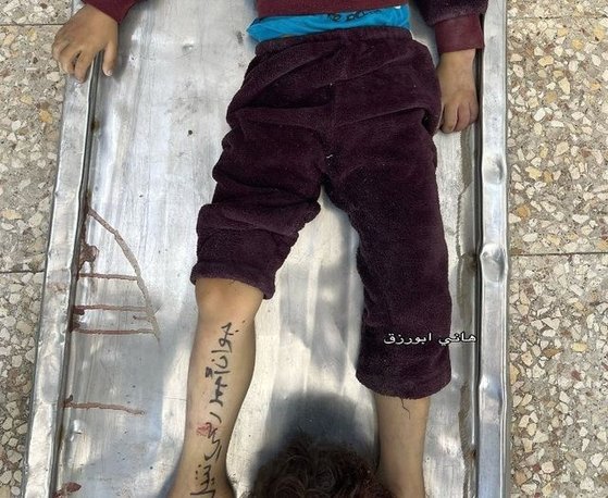 パレスチナ・ガザ地区のある子どもの足に名前が書かれている。［写真　パレスチナのジャーナリスト「ハニ・アブレスク」　インスタグラム　キャプチャー］