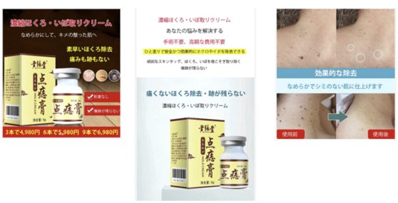 １３日、日本国民生活センター（ＮＣＡＣ）は、最近ＳＮＳ広告を見て中国からの個人輸入を通じて「ほくろクリーム」を購入して皮膚に塗ったところ、皮膚が化学熱傷で壊死する事例が多数報告されたとして注意を呼びかけた。［写真　ＮＣＡＣ公式サイト　キャプチャー］