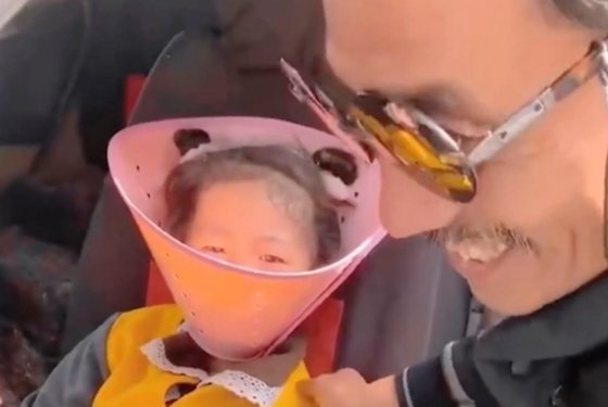 孫娘に「エリザベスカラー」をつけた中国男性 ［微博　キャプチャー］