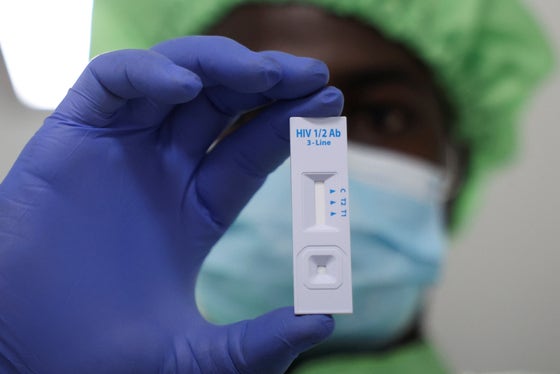 ＨＩＶ検査キット。［写真　ロイター＝聯合ニュース］