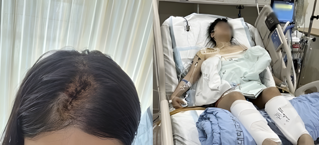 モンキースパナなどの凶器で襲われ、大けがを負った被害者の様子。［オンラインコミュニティ］