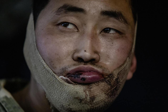 ゼレンスキー大統領は昨年1月、ウクライナ軍がロシア西部クルスク州で北朝鮮兵2人を捕虜にしたと明らかにした。ゼレンスキー大統領はX（旧ツイッター）で、北朝鮮兵2人は負傷した状態でキーウに移送され、ウクライナ保安庁（SBU）の取り調べを受けていると伝えた。写真はゼレンスキー大統領が公開した北朝鮮兵。［ニュース1］